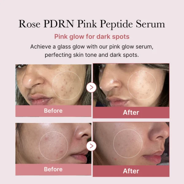 Medicube - PDRN Pink Peptide Serum - 30ml – Image 5